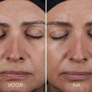 Voor en na foto DAILY PREVENTION – ADVANCED SMARTBLEND MINERAL MOISTURIZER SPF 50+