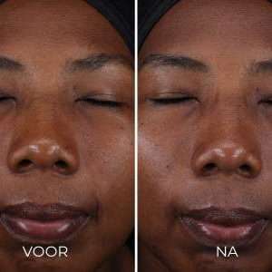 Voor en na foto: DAILY PREVENTION - Pure Mineral Tinted Moisturizer SPF 30