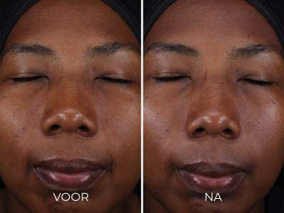 Voor en na foto: DAILY PREVENTION - Pure Mineral Tinted Moisturizer SPF 30