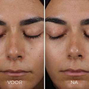 Resultaat van de DAILY PREVENTION - Sheer Matte Moisturizer SPF 30