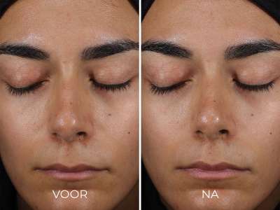 Resultaat van de DAILY PREVENTION - Sheer Matte Moisturizer SPF 30