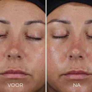 DAILY PREVENTION Ultra Defense Moisturizer SPF 50 - voor en na foto