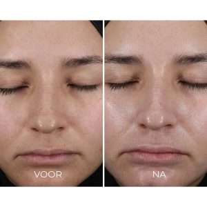 Resultaat IMAGE Skincare daily prevention pure mineral hydrating moisturizer SPF30