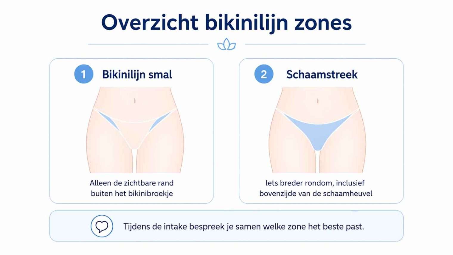 Overzicht van bikinilijn zones voor laserontharen: bikinilijn smal en schaamstreek